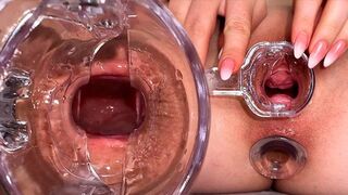 Regarde dans mon trou du cul ! dilatation anale et orgasme d'ouverture