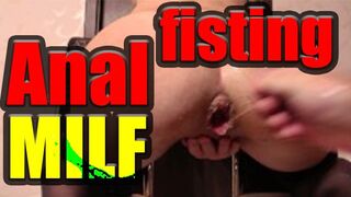 Vous pouvez regarder une sale, anal Milf poings lui-même gratuitement